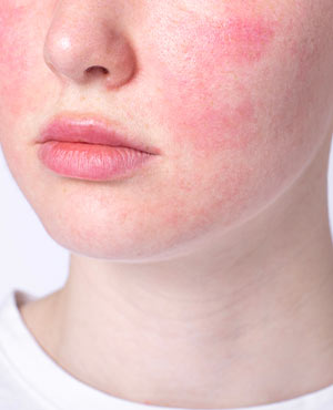 Autoimmune Conditions Near Me in Fredericksburg, VA
